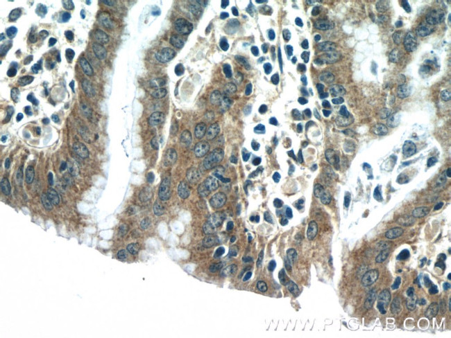 NFATC2 Antibody in Immunohistochemistry (Paraffin) (IHC (P))