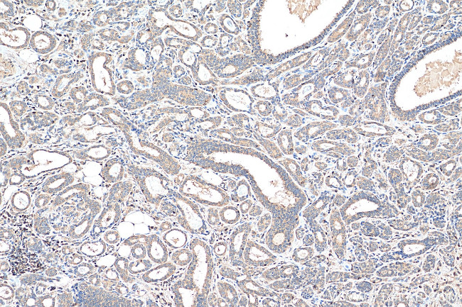 NFATC2 Antibody in Immunohistochemistry (Paraffin) (IHC (P))