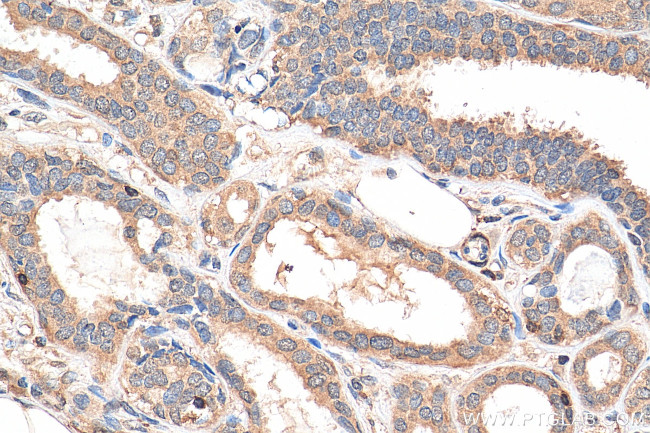 NFATC2 Antibody in Immunohistochemistry (Paraffin) (IHC (P))