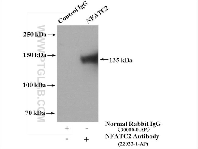 NFATC2 Antibody in Immunoprecipitation (IP)