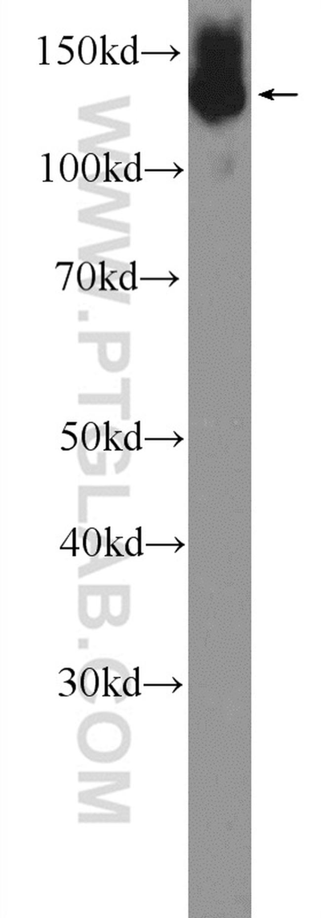 NFATC2 Antibody in Western Blot (WB)