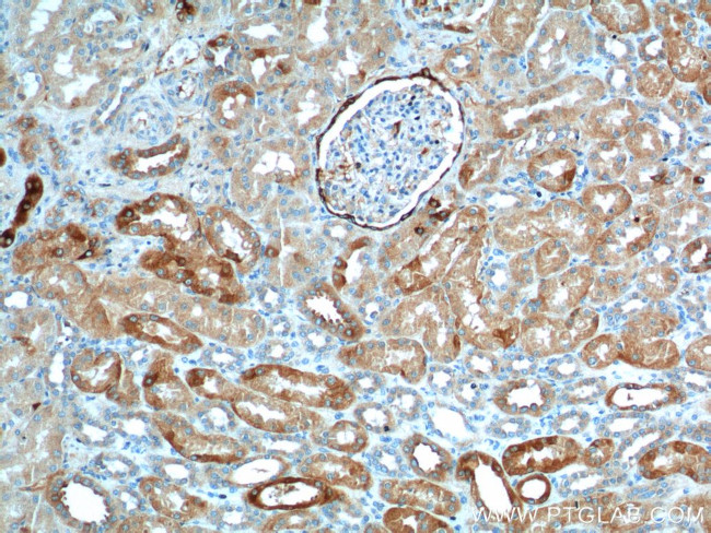 PIGR Antibody in Immunohistochemistry (Paraffin) (IHC (P))