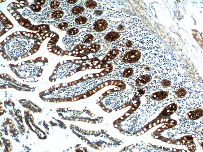 PIGR Antibody in Immunohistochemistry (Paraffin) (IHC (P))