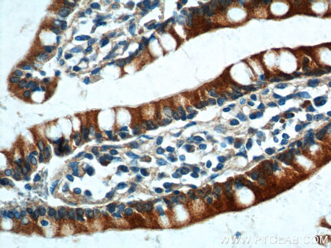 PIGR Antibody in Immunohistochemistry (Paraffin) (IHC (P))