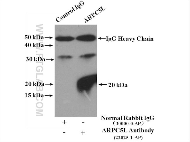 ARPC5L Antibody in Immunoprecipitation (IP)