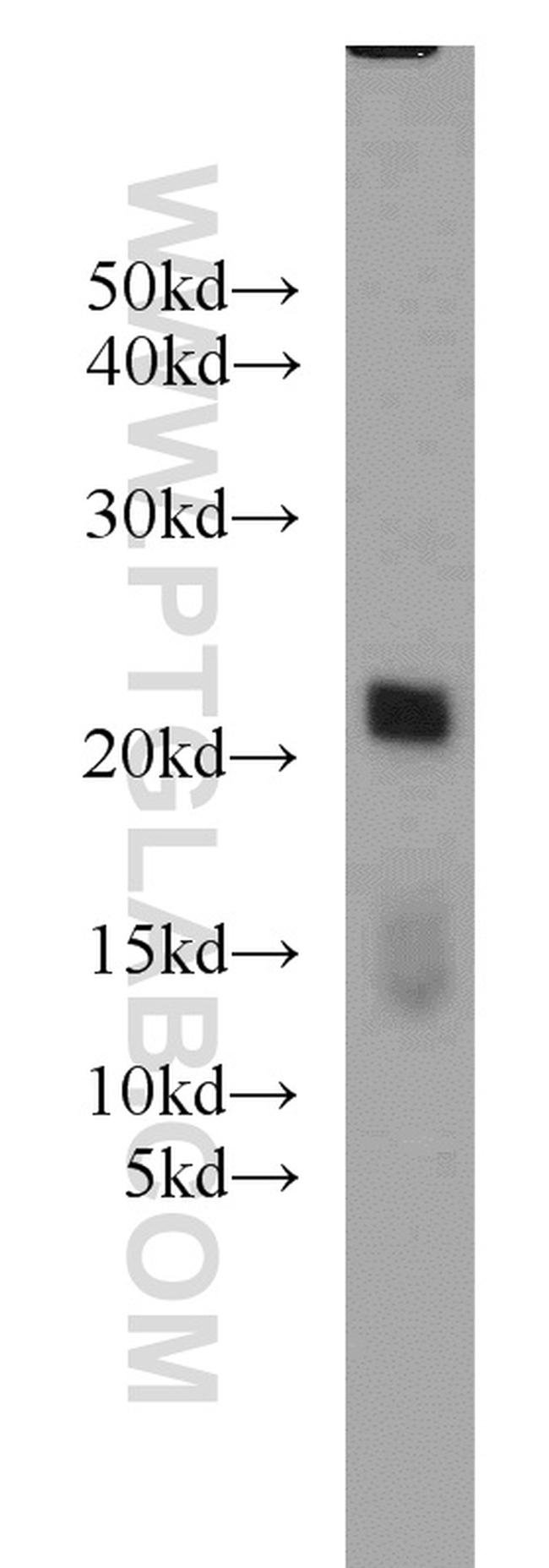ARPC5L Antibody in Western Blot (WB)