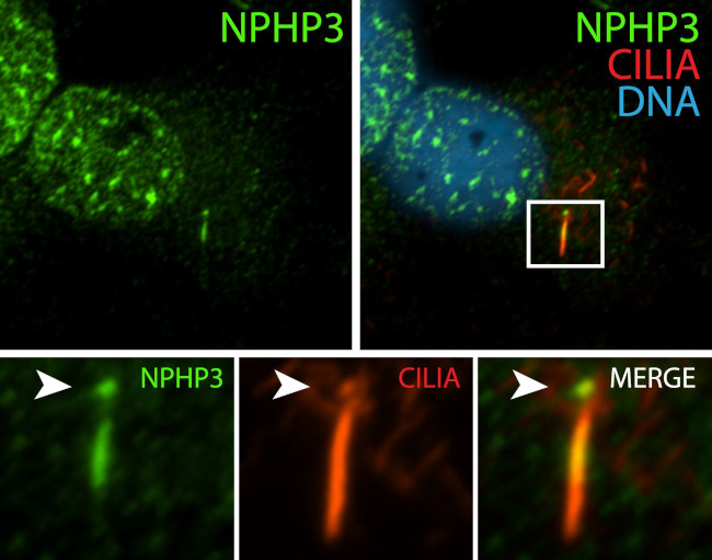 NPHP3 Antibody in Immunocytochemistry (ICC/IF)