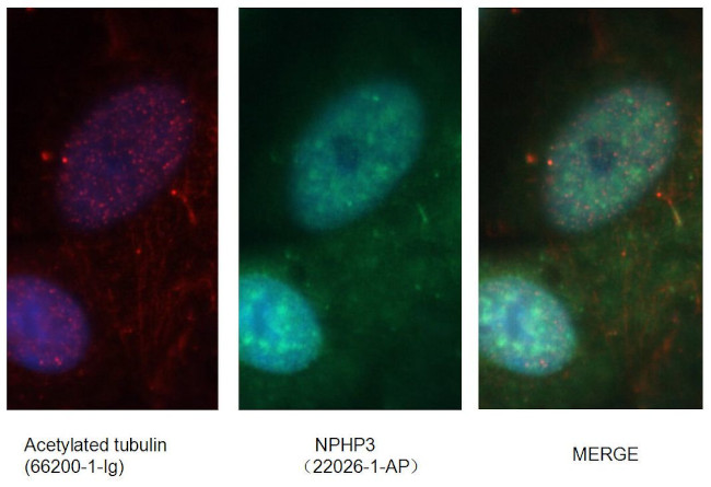 NPHP3 Antibody in Immunocytochemistry (ICC/IF)