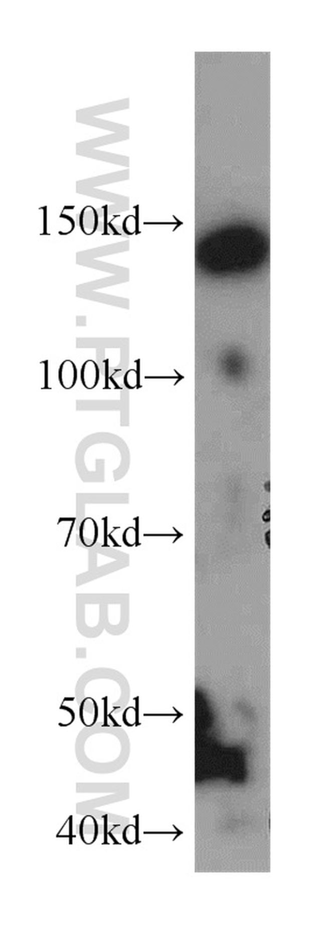 NPHP3 Antibody in Western Blot (WB)