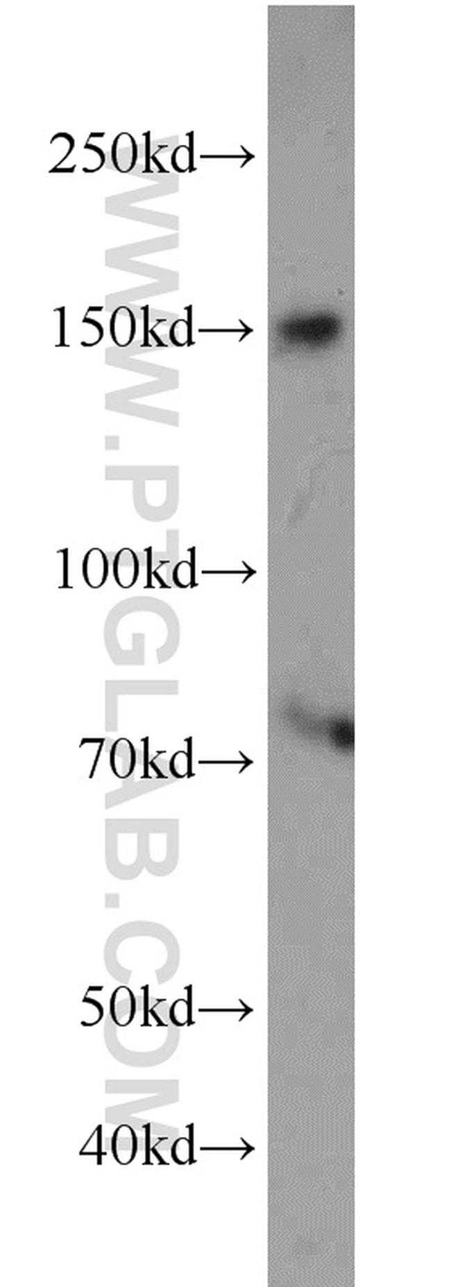 NPHP3 Antibody in Western Blot (WB)