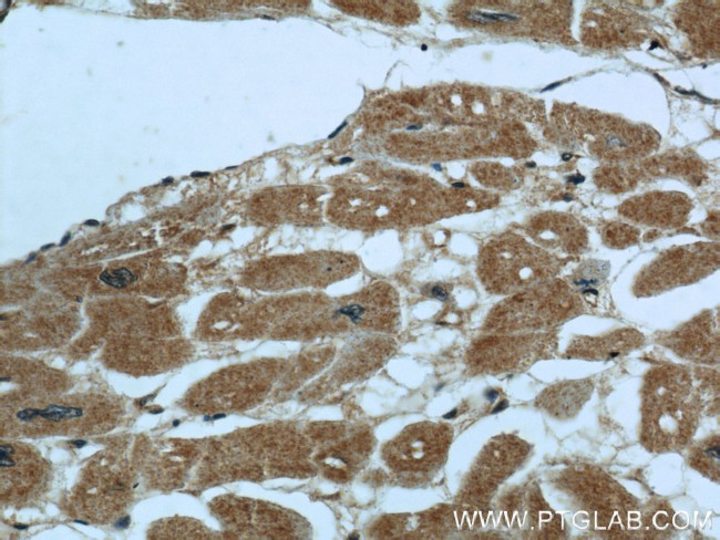 PIK3C2A Antibody in Immunohistochemistry (Paraffin) (IHC (P))