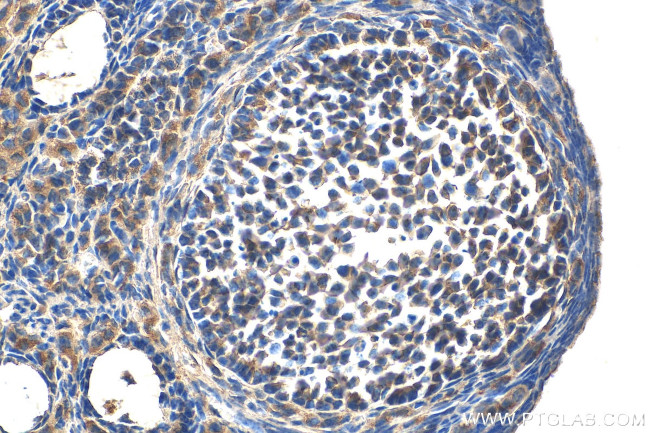 PIK3C2A Antibody in Immunohistochemistry (Paraffin) (IHC (P))