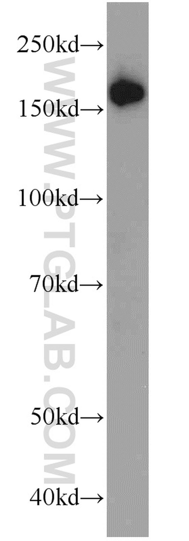 PIK3C2A Antibody in Western Blot (WB)