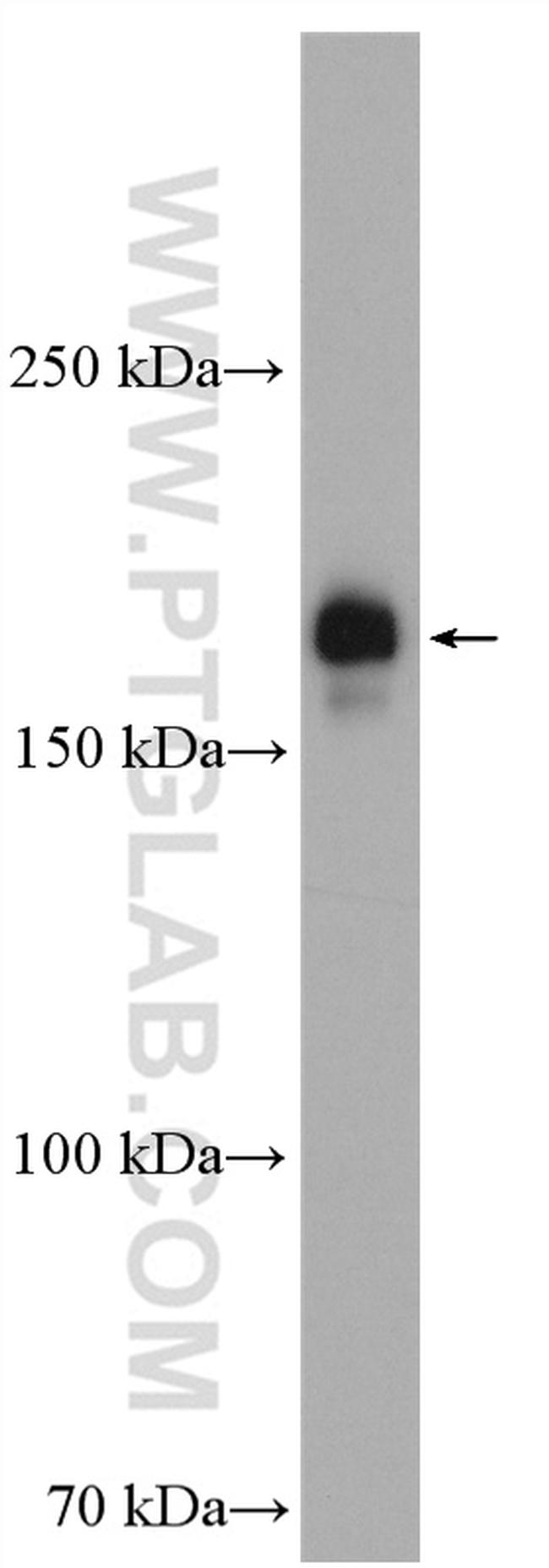 PIK3C2A Antibody in Western Blot (WB)