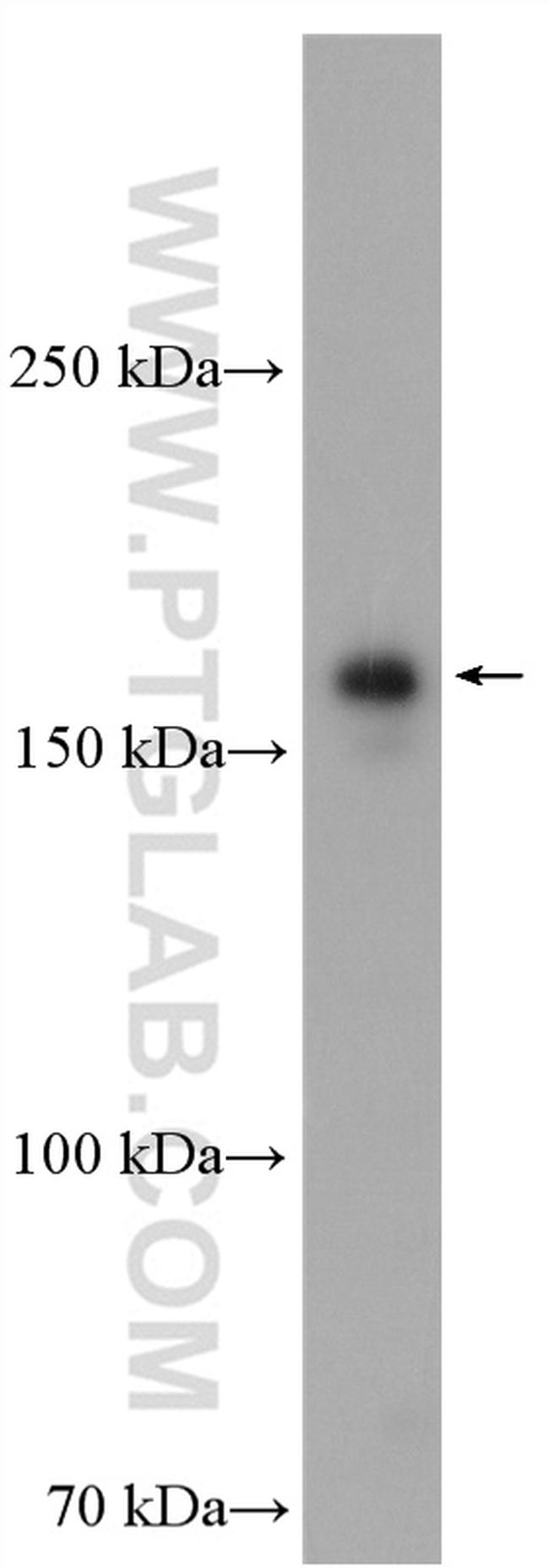 PIK3C2A Antibody in Western Blot (WB)