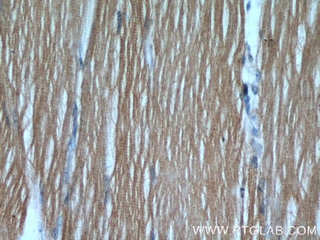 Hexokinase 2 Antibody in Immunohistochemistry (Paraffin) (IHC (P))