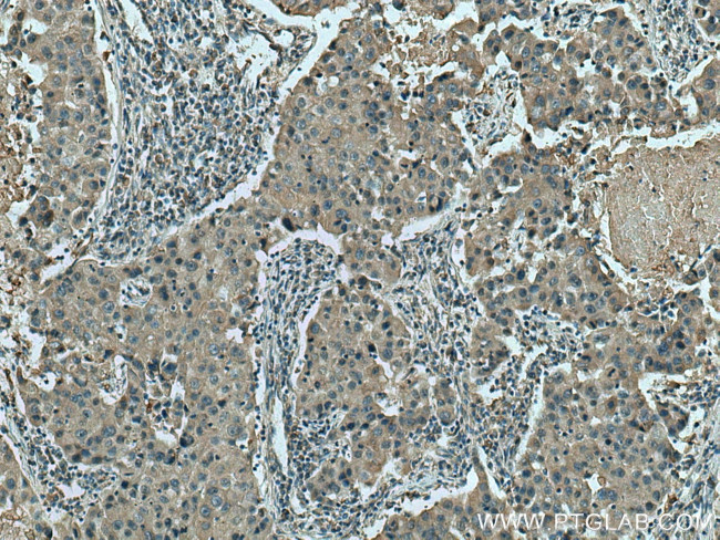 Hexokinase 2 Antibody in Immunohistochemistry (Paraffin) (IHC (P))