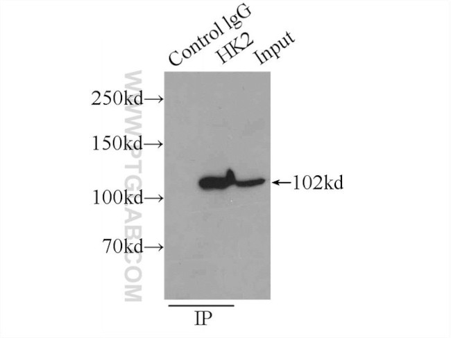 Hexokinase 2 Antibody in Immunoprecipitation (IP)