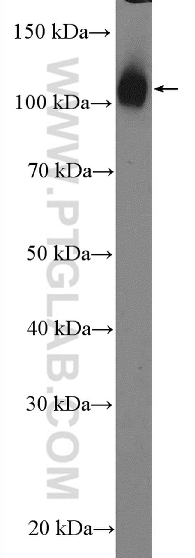 Hexokinase 2 Antibody in Western Blot (WB)