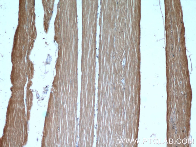 Hexokinase 2 Antibody in Immunohistochemistry (Paraffin) (IHC (P))