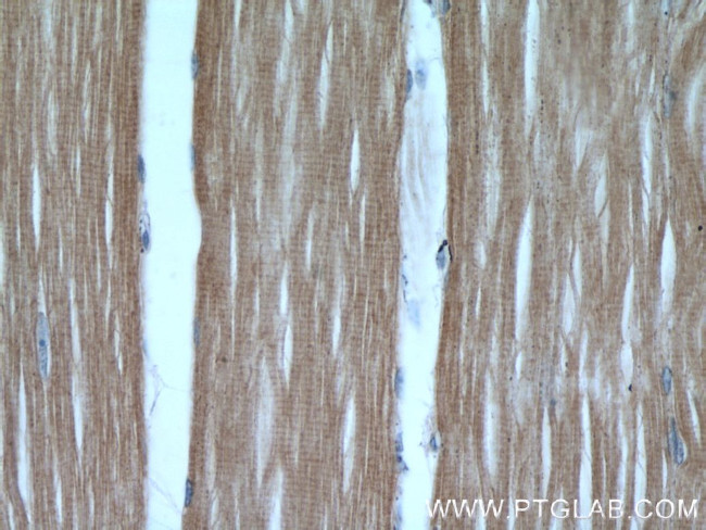 Hexokinase 2 Antibody in Immunohistochemistry (Paraffin) (IHC (P))