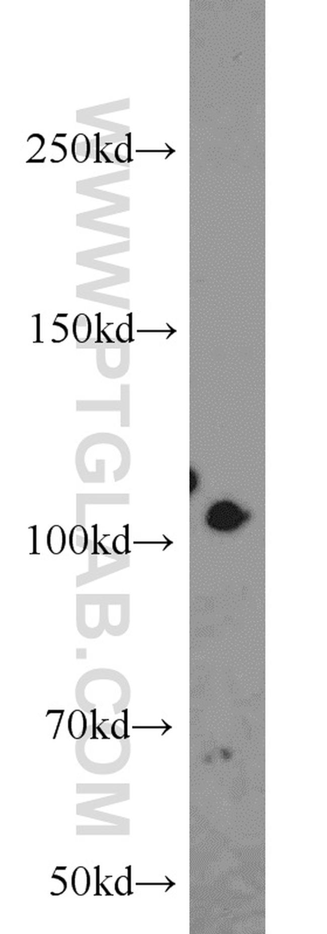 Hexokinase 2 Antibody in Western Blot (WB)