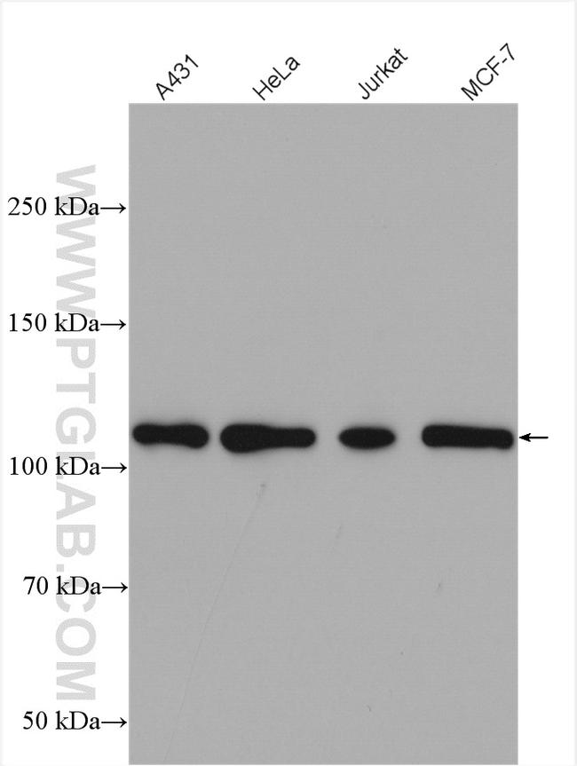 Hexokinase 2 Antibody in Western Blot (WB)