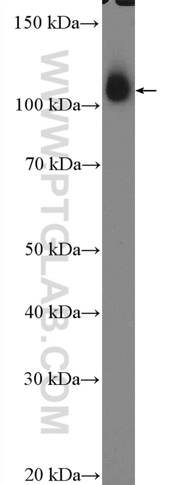 Hexokinase 2 Antibody in Western Blot (WB)