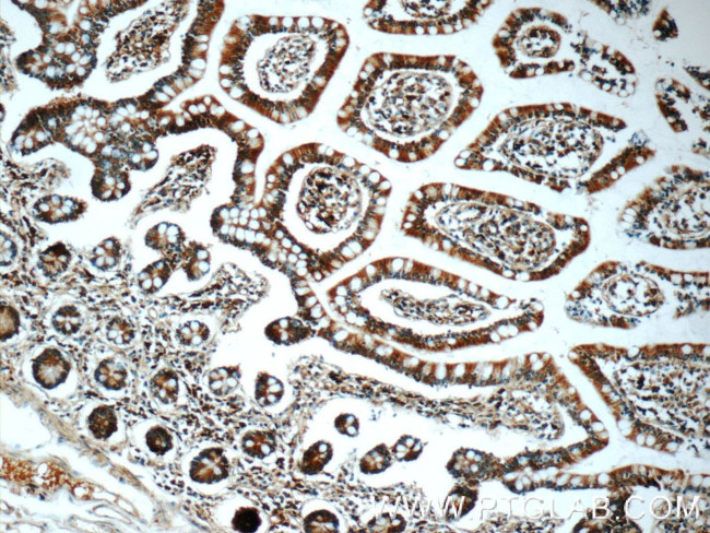 iPLA2 Antibody in Immunohistochemistry (Paraffin) (IHC (P))