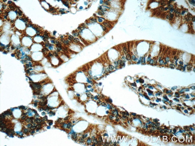 iPLA2 Antibody in Immunohistochemistry (Paraffin) (IHC (P))