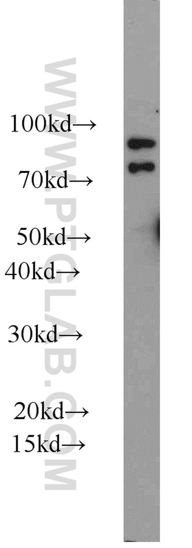 iPLA2 Antibody in Western Blot (WB)