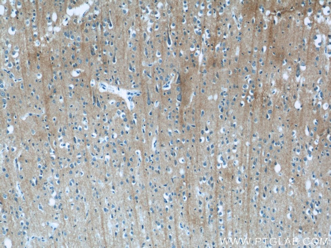 iPLA2 Antibody in Immunohistochemistry (Paraffin) (IHC (P))