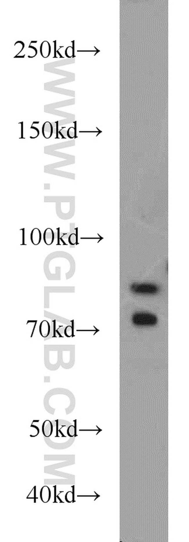 iPLA2 Antibody in Western Blot (WB)