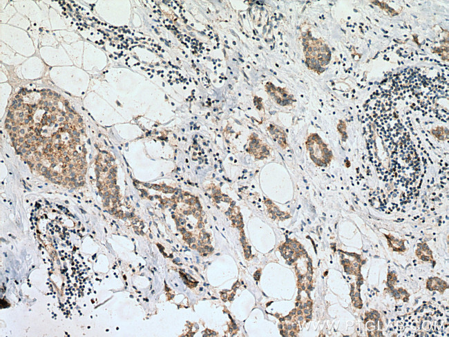 Bim Antibody in Immunohistochemistry (Paraffin) (IHC (P))