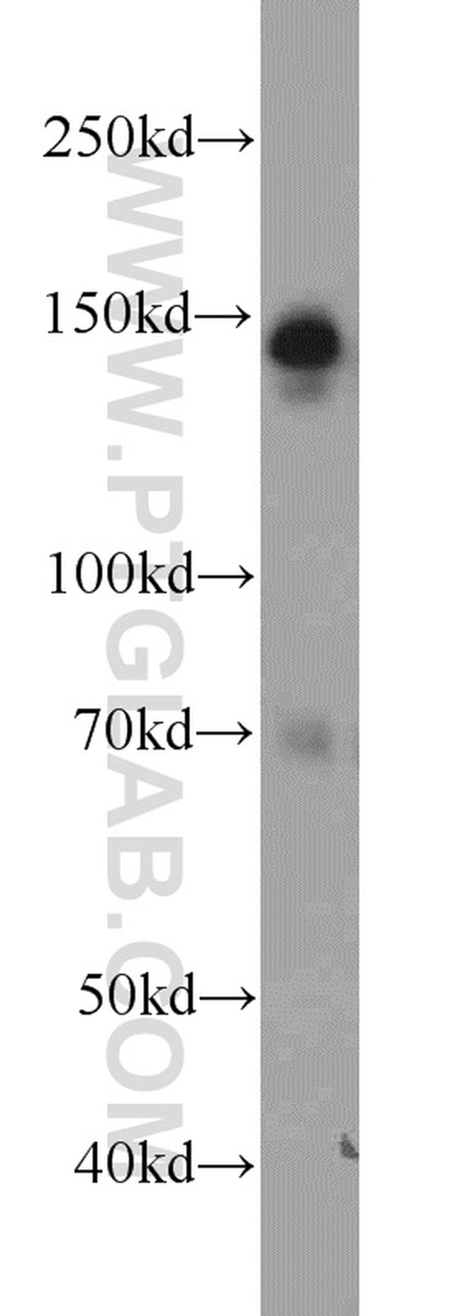 AHI1 Antibody in Western Blot (WB)