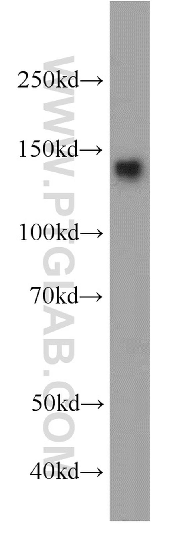 AHI1 Antibody in Western Blot (WB)