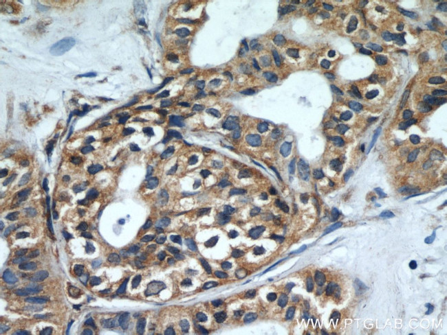 CEP97 Antibody in Immunohistochemistry (Paraffin) (IHC (P))