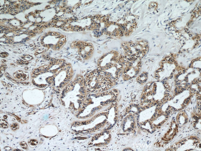 CEP97 Antibody in Immunohistochemistry (Paraffin) (IHC (P))