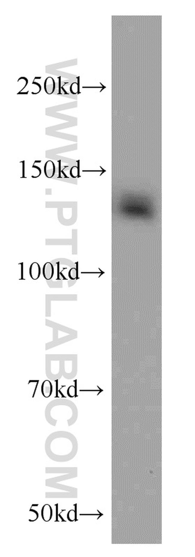 CEP97 Antibody in Western Blot (WB)