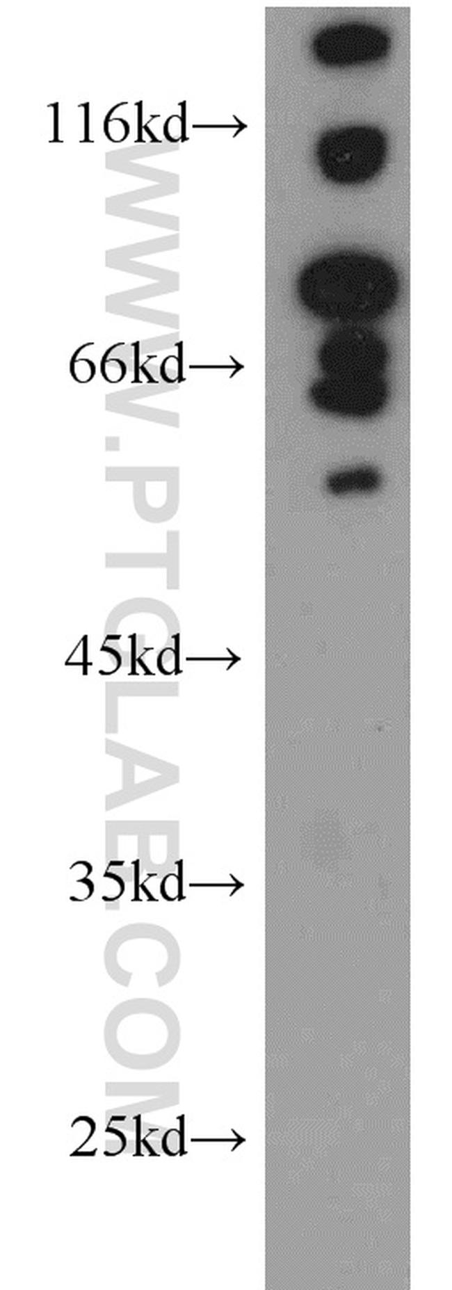 FOXP1 Antibody in Western Blot (WB)