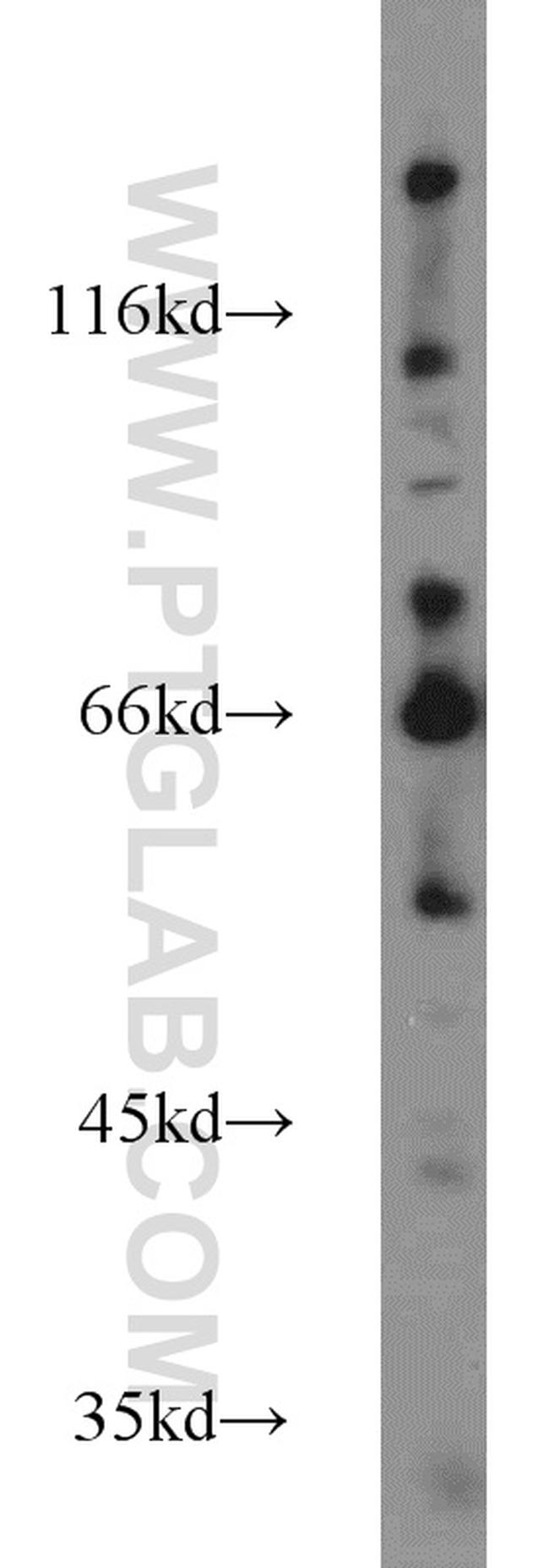 FOXP1 Antibody in Western Blot (WB)