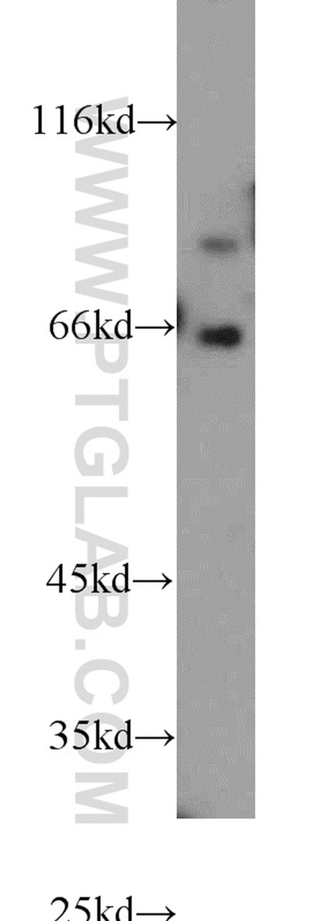 FOXP1 Antibody in Western Blot (WB)