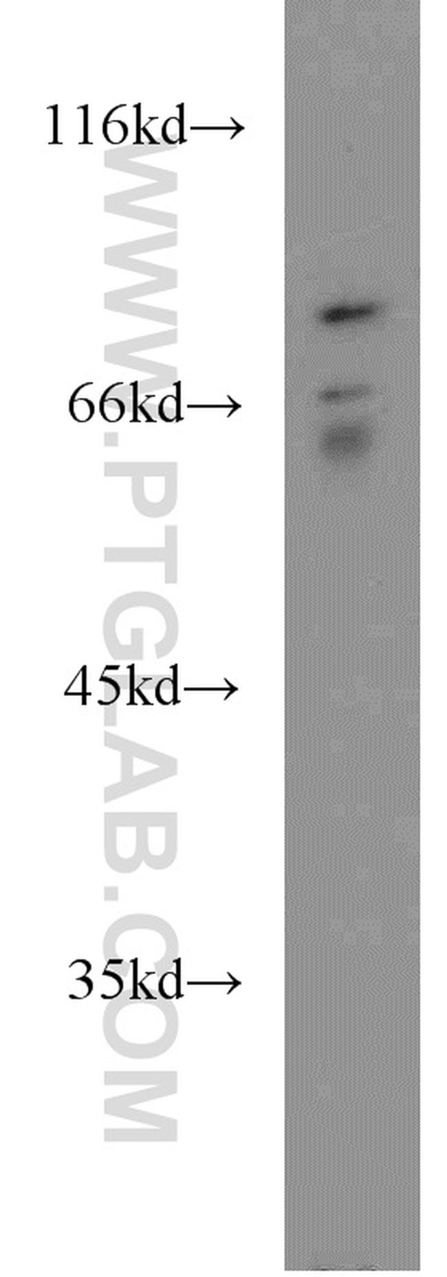 FOXP1 Antibody in Western Blot (WB)