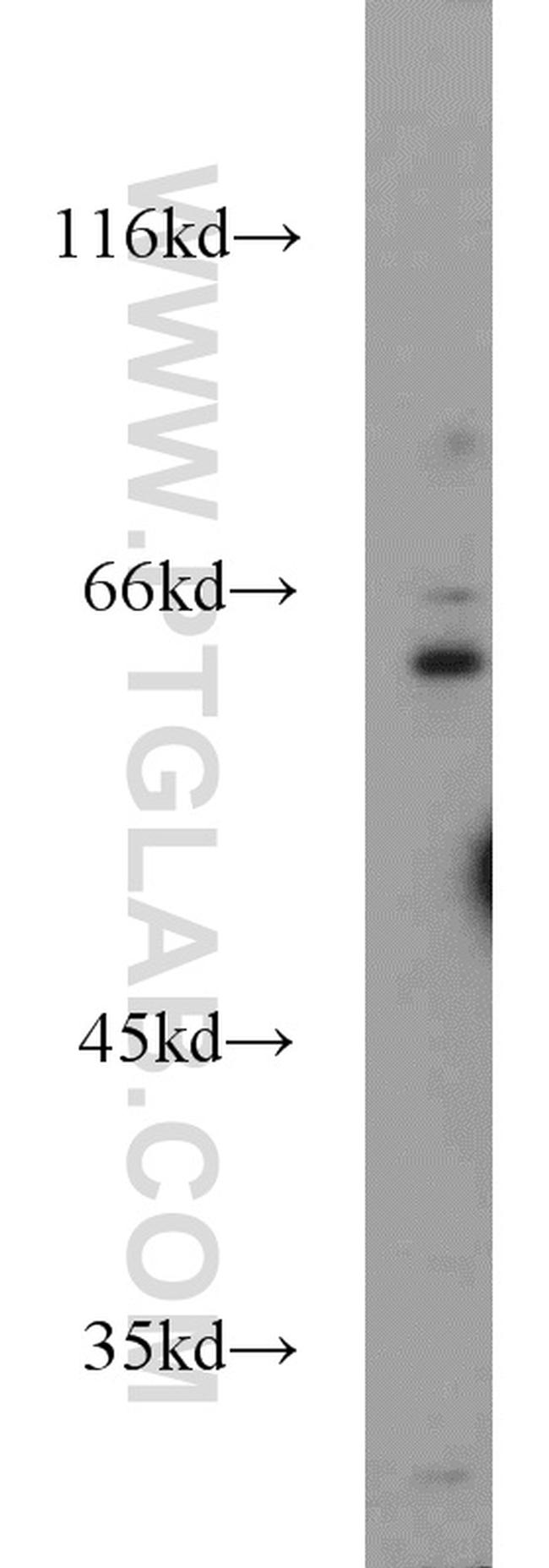 FOXP1 Antibody in Western Blot (WB)