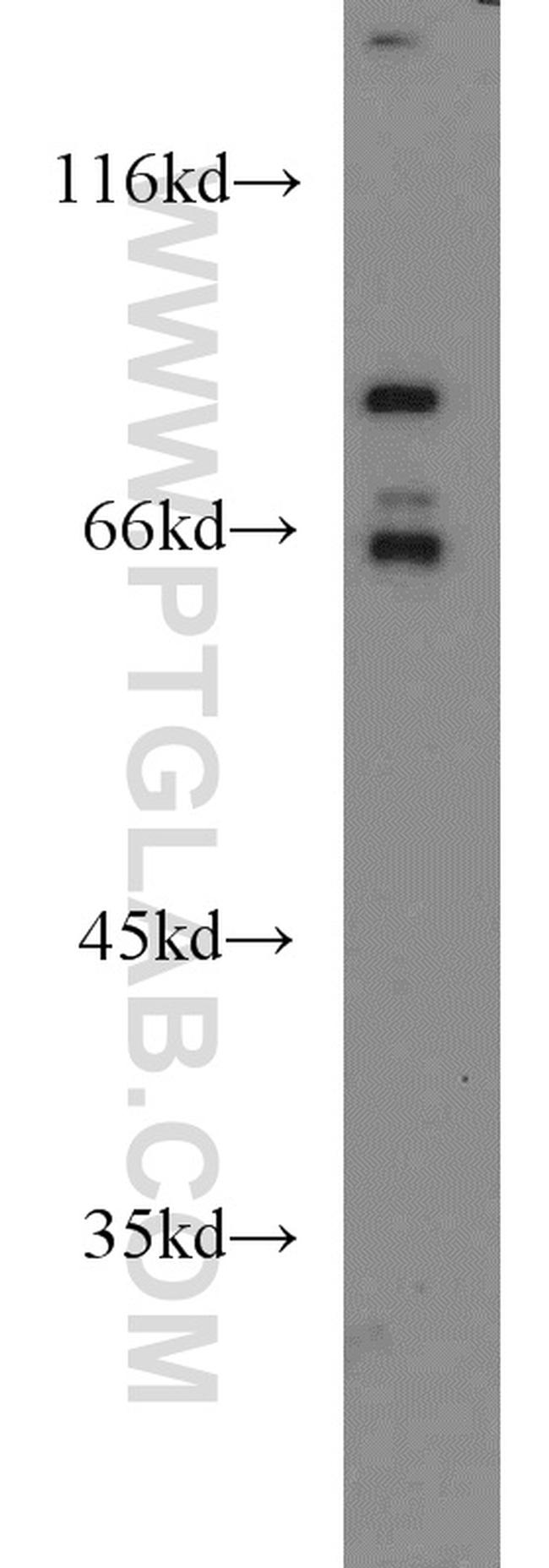 FOXP1 Antibody in Western Blot (WB)