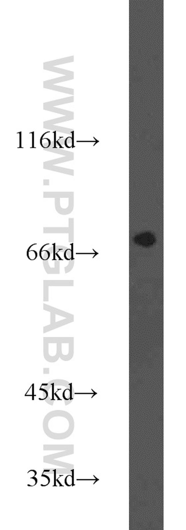 FOXP1 Antibody in Western Blot (WB)