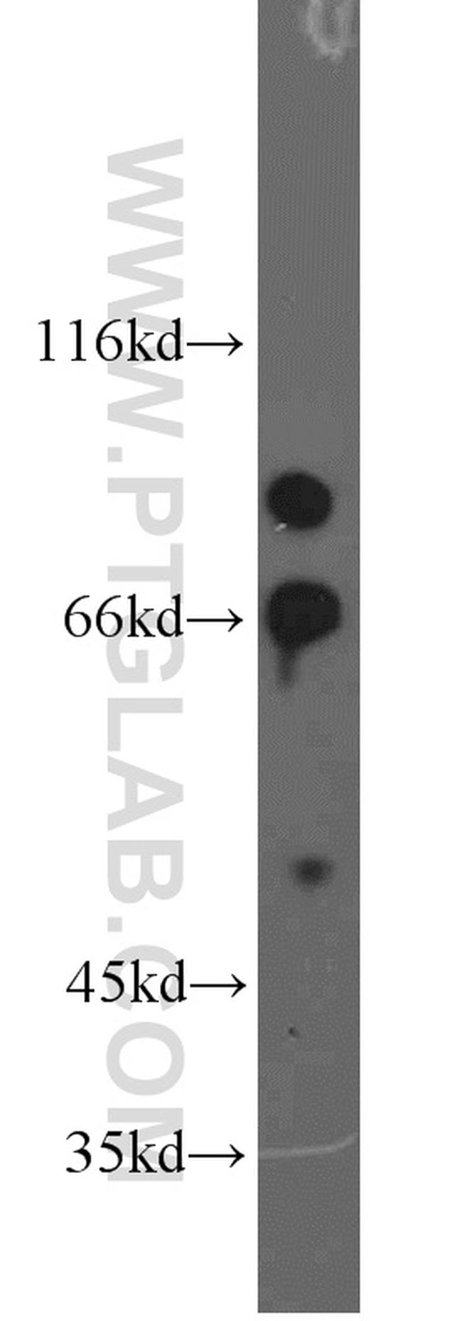 FOXP1 Antibody in Western Blot (WB)