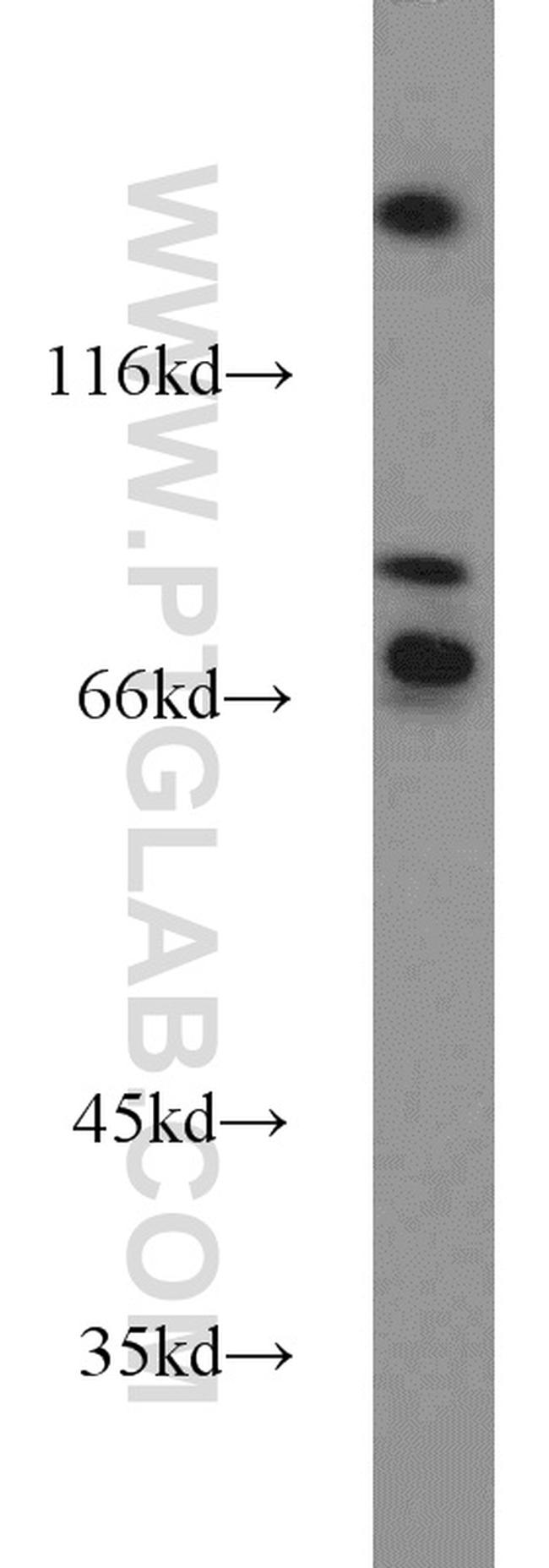 FOXP1 Antibody in Western Blot (WB)