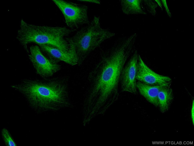 MAGED1 Antibody in Immunocytochemistry (ICC/IF)