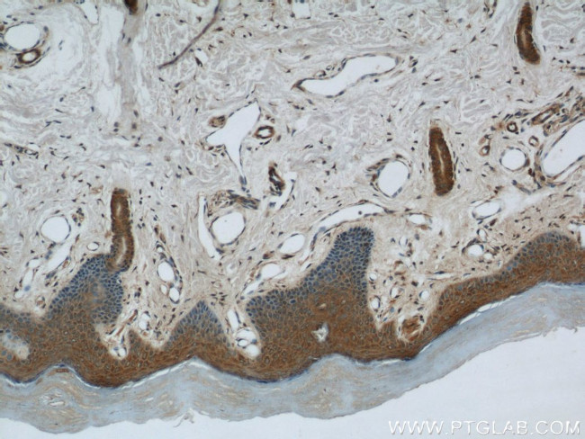 MAGED1 Antibody in Immunohistochemistry (Paraffin) (IHC (P))